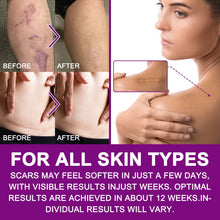 Load image into Gallery viewer, Silicone Women Invisible Efficient Surgery Scar Removal Gel Therapy Patches Acne Trauma Scald Scar Skin Repair Caesarean Section Treatment
