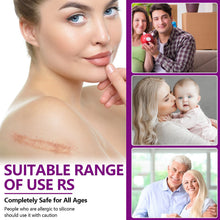 Load image into Gallery viewer, Silicone Women Invisible Efficient Surgery Scar Removal Gel Therapy Patches Acne Trauma Scald Scar Skin Repair Caesarean Section Treatment
