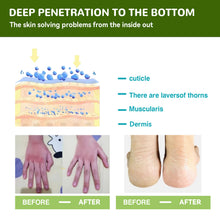 Load image into Gallery viewer, Moisturizing Anti cracking Foot Cream Anti-Drying Heel Cracked Repair Calluses Dead Skin Removal Hand Foot Protection Cream
