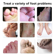 Load image into Gallery viewer, Foot Care Ointment Foot Skin Care Protect From Feet Rotten Peeling Itching Health Care Bacteriostatic Antipruritic Beriberi Ointment
