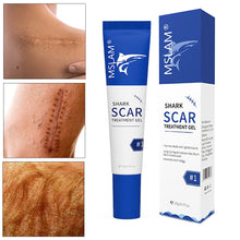 Load image into Gallery viewer, Scar Removal Cream Acne Spots Remove Burn Surgical Scar Repair Cream Smoothing Cream Treatment Hyperplastic Scar Repair Gel
