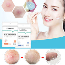 Load image into Gallery viewer, Mini Acne Pimple Patch Invisible Acne Removal Patches Acne Treatment Acne Master Pimple Remover Daily / Night Stickers
