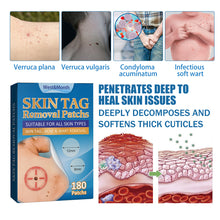 Load image into Gallery viewer, 180PCS Skin Tag Wart Remove Wart Acuminate Skin Repair Stick Acne Pimple Patch Pimple Treatments Patches Cream Warts Sticker
