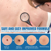 Load image into Gallery viewer, 180PCS Skin Tag Wart Remove Wart Acuminate Skin Repair Stick Acne Pimple Patch Pimple Treatments Patches Cream Warts Sticker
