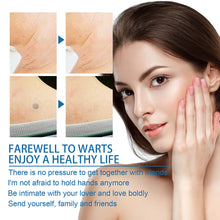 Load image into Gallery viewer, 180PCS Skin Tag Wart Remove Wart Acuminate Skin Repair Stick Acne Pimple Patch Pimple Treatments Patches Cream Warts Sticker
