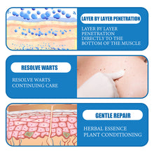 Load image into Gallery viewer, 180PCS Skin Tag Wart Remove Wart Acuminate Skin Repair Stick Acne Pimple Patch Pimple Treatments Patches Cream Warts Sticker
