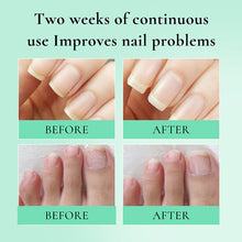 Load image into Gallery viewer, Nail Repairing Liquid Finger Edge Nutrition Oil Nourishing Anti Edge Anti Barb Shining Nail Care Essence Oil Regrowth Treatment Gel
