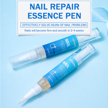 Load image into Gallery viewer, Nail Fungal Removal Treatment Essence Pen Anti Infection Paronychia Onychomycosis Nail Repair Pen Foot Toenail Gel Feet Care Repair Liquid
