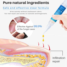 Load image into Gallery viewer, Nail Fungal Removal Treatment Essence Pen Anti Infection Paronychia Onychomycosis Nail Repair Pen Foot Toenail Gel Feet Care Repair Liquid
