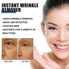 Load image into Gallery viewer, Retinol Wrinkles Removal Face Cream lighten eye edema Firming Anti-aging Fade Eyes Puffiness Fine Lines Moisturizing Skin Care
