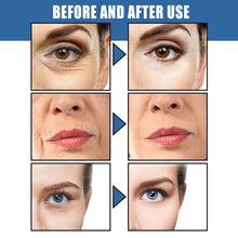 Load image into Gallery viewer, Retinol Wrinkles Removal Face Cream lighten eye edema Firming Anti-aging Fade Eyes Puffiness Fine Lines Moisturizing Skin Care
