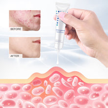 Load image into Gallery viewer, Acne Removal Face Cream Anti-Acne Gel Treatment Acne Scar Oil Control Eliminate Pimples Whitening Moisturizing Face Care
