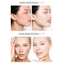 Load image into Gallery viewer, Vitamin C Whitening Freckle Cream Instant Remove Face Melasma Dark Spot Melanin Moisturizer Anti-aging Brighten Beauty Skin Care
