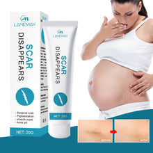 Load image into Gallery viewer, Scar Removal Cream Repair Stretch Marks Burn Acne Surgical Acne Scar Ointment Herbal Treatment Gel Whitening Beauty Health Care
