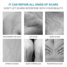 Load image into Gallery viewer, Scar Removal Cream Repair Stretch Marks Burn Acne Surgical Acne Scar Ointment Herbal Treatment Gel Whitening Beauty Health Care
