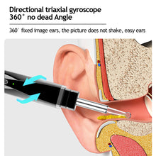Load image into Gallery viewer, Wireless Smart Visual Ear Wax Otoscope Ear Cleaner Removal Tool Intelligent Luminous Camera Ear Endoscope Cleaner Kit
