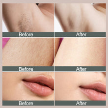 Load image into Gallery viewer, Intelligence Laser Epilator Flashes IPL Laser Hair Removal Permanent Photoepilator Depilatory Apparatus Women Health Care
