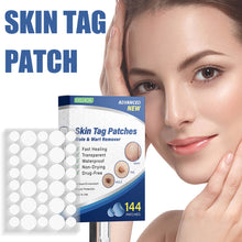 Load image into Gallery viewer, 144pcs Wart Treatment Stickers Skin Tag Remover Patches Treatments Hydrocolloid Gel Acne Warts Invisible Skin Care
