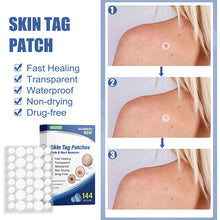 Load image into Gallery viewer, 144pcs Wart Treatment Stickers Skin Tag Remover Patches Treatments Hydrocolloid Gel Acne Warts Invisible Skin Care
