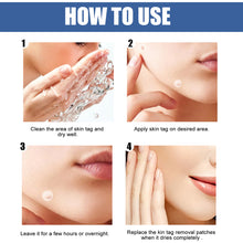 Load image into Gallery viewer, 144pcs Wart Treatment Stickers Skin Tag Remover Patches Treatments Hydrocolloid Gel Acne Warts Invisible Skin Care
