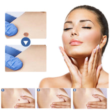 Load image into Gallery viewer, 144pcs Wart Treatment Stickers Skin Tag Remover Patches Treatments Hydrocolloid Gel Acne Warts Invisible Skin Care
