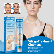 Load image into Gallery viewer, White Spot Removal Extract Vitiligo Ointment Remove Ringworm Skin White Spot Leukoplakia Disease Treatment Cream
