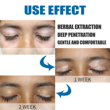 Load image into Gallery viewer, White Spot Removal Extract Vitiligo Ointment Remove Ringworm Skin White Spot Leukoplakia Disease Treatment Cream
