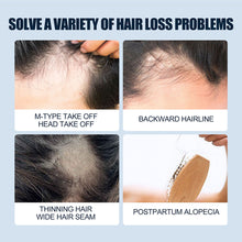 Load image into Gallery viewer, 1 Original Kirkland Minoxidil with FREE LCLT and Dropper Hair Grower Beard Grower Creative Effective Hair Growth Health Care
