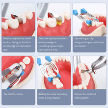 Load image into Gallery viewer, Dental Doublet Shaped Sheet Clamp Shaped Sheet Clamp Doublet Shaped Sheet Clamp Tooth Doublet Holding Ring
