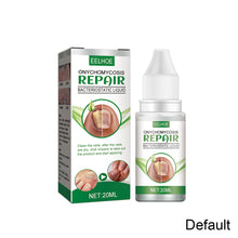Load image into Gallery viewer, 20ml Onychomycosis Liquid Onychomycosis Care Repair Liquid Nail Feet Onychomycosis Liquid Nail Care Liquid Health Care
