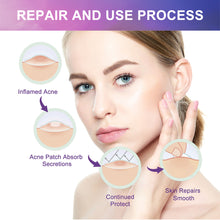 Load image into Gallery viewer, Colorful Acne Patches Fade Spots Acne Hydrogel Patches Repair Facial Acne Defects Skin Care Beauty Health
