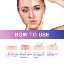 Load image into Gallery viewer, Colorful Acne Patches Fade Spots Acne Hydrogel Patches Repair Facial Acne Defects Skin Care Beauty Health
