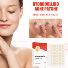 Load image into Gallery viewer, Hydrocolloid Acne Patch Waterproof Breathable Invisible Acne Patch Pimple Remover Patch Skin Care Repair
