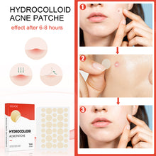 Load image into Gallery viewer, Hydrocolloid Acne Patch Waterproof Breathable Invisible Acne Patch Pimple Remover Patch Skin Care Repair
