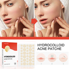 Load image into Gallery viewer, Hydrocolloid Acne Patch Waterproof Breathable Invisible Acne Patch Pimple Remover Patch Skin Care Repair
