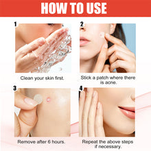 Load image into Gallery viewer, Hydrocolloid Acne Patch Waterproof Breathable Invisible Acne Patch Pimple Remover Patch Skin Care Repair
