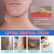 Load image into Gallery viewer, Lipoma Cream Reduce Inflammation Remove Lipomas Fibromas Subcutaneous Masses Body Care Cream Health Care
