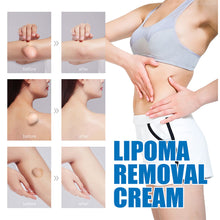 Load image into Gallery viewer, Lipoma Cream Reduce Inflammation Remove Lipomas Fibromas Subcutaneous Masses Body Care Cream Health Care

