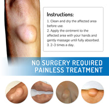 Load image into Gallery viewer, Lipoma Cream Reduce Inflammation Remove Lipomas Fibromas Subcutaneous Masses Body Care Cream Health Care
